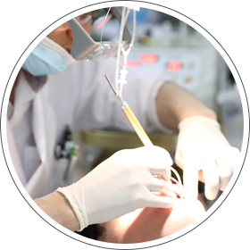 プラズマレーザー治療